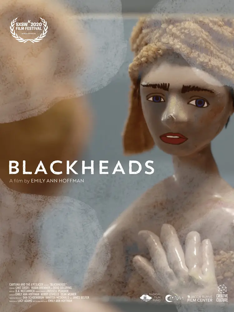 Blackheads Image
