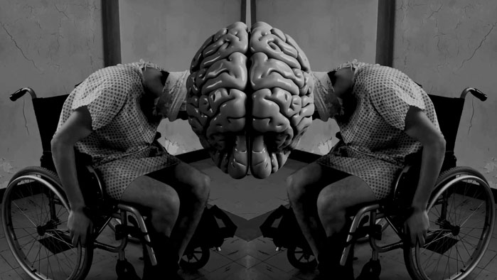 The Cerebral Organoid Image