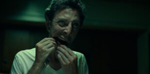 Bad Tooth Image